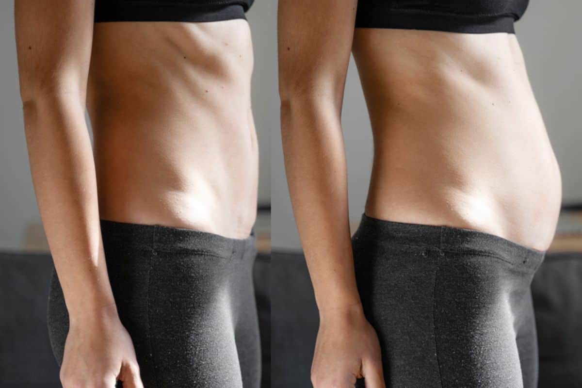 How long does diastasis recti take to improve South Kensington?