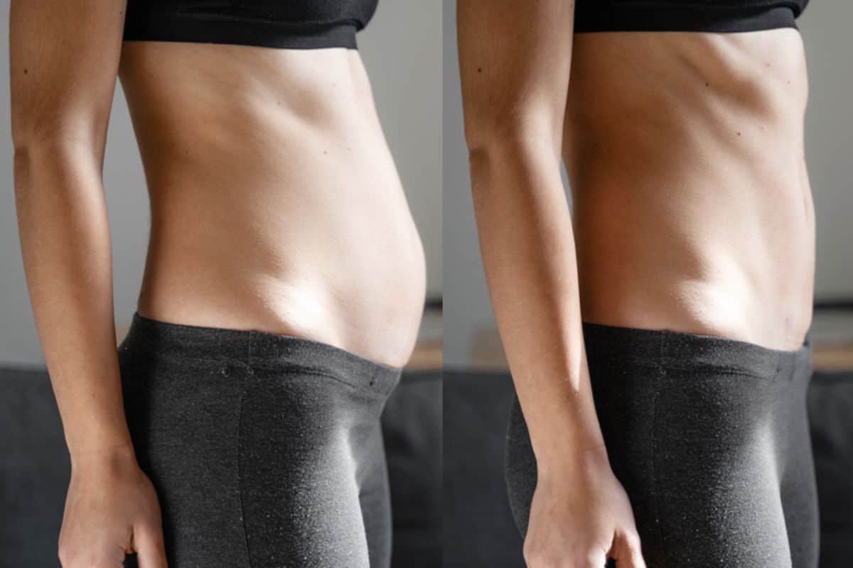 Post-Pregnancy: What Happens to Your Abdominal Muscles After Birth South Kensington