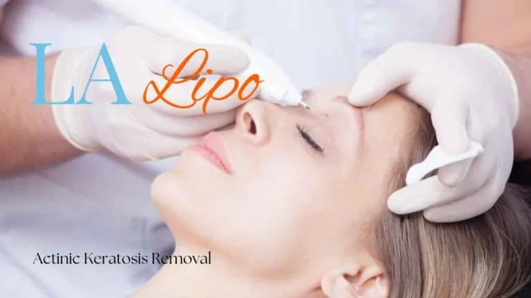 Woman receiving Actinic Keratosis Removal Treatment South Kensington