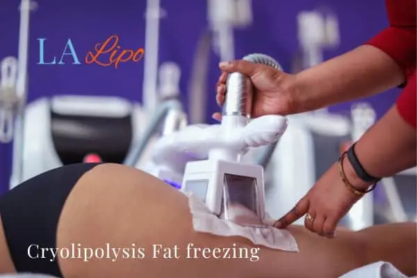 women getting fat freezing South Kensington