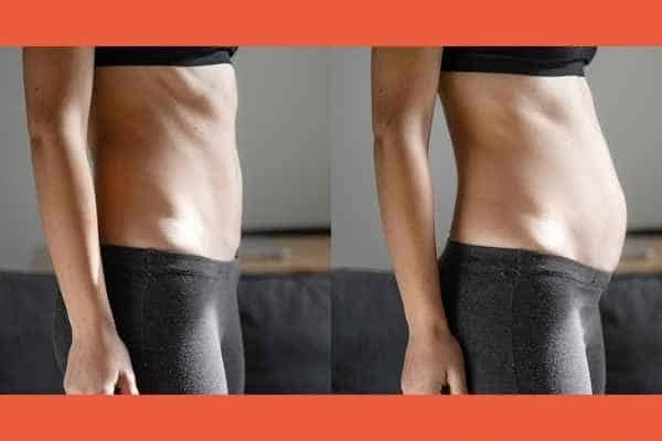 LA-EMS Body Sculpting results South Kensington