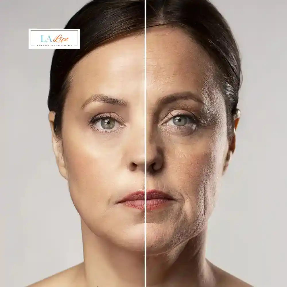 How Can You Tell If Non-Surgical Skin Tightening Is Right for You South Kensington?